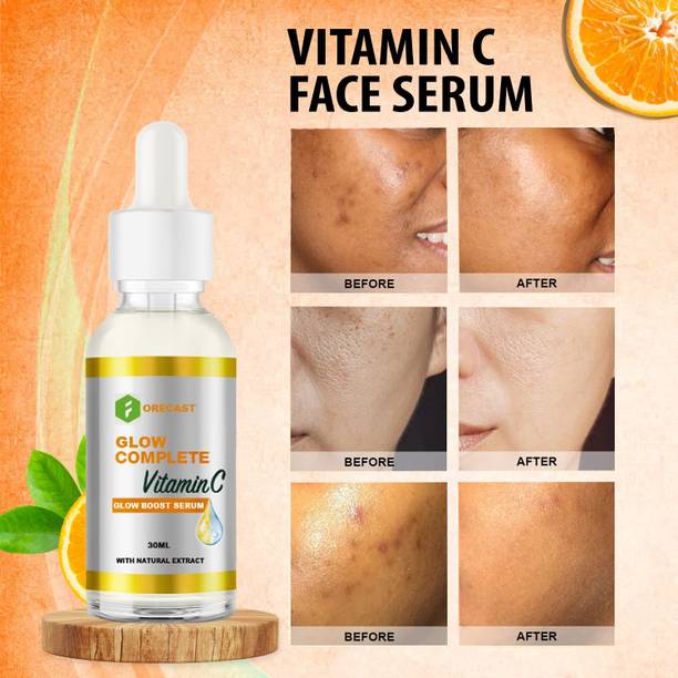 Forecast Advanced Vitamin C Face Serum – Fade Dark Spots, Uneven Skin Tone & Boost Radiance