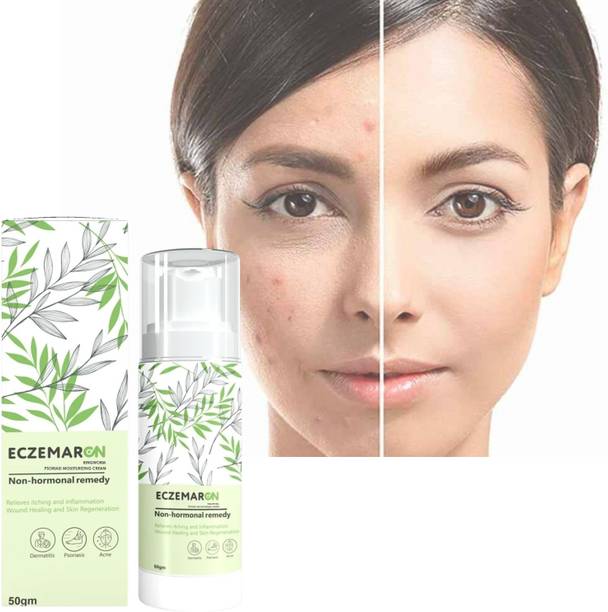 Eczemaron Ringworm Anti-Fungal Cream: Rapid Healing for Skin Ayurvedic Skin Tretment (52 ml)