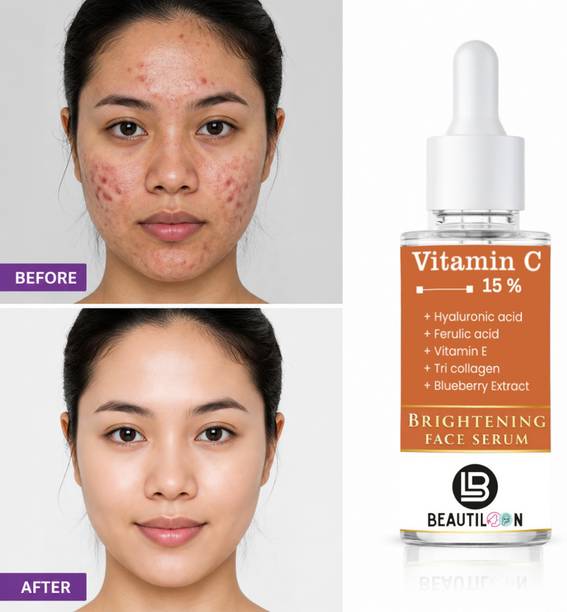 beautiloon Vitamin C Serum for Face Glow and Skin Repair with Dark Spot Corrector Pigmentation Removal Acne Scar Treatment Wrinkle Reduction Moisturizing Hydration Anti Aging Face Care and Smooth Radiant Skin 30ml