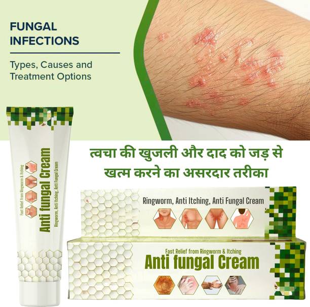 LILIPATI Antifungal Cream for Ringworm, Itching & Skin Infection | Daad Khaj Khujli Relief Cream for Men & Women (Fast Action Formula)