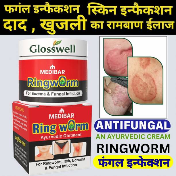 glosswell Herbal Ringworm Solution Cream for Skin Irritation and Itching