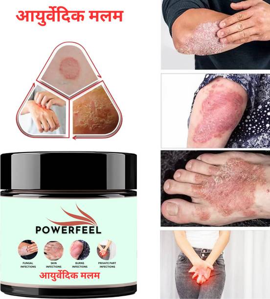 POWERFEEL ItchCoat Anti fungal Malam - for Ringworm, itching, Eczema & Fungal Infection