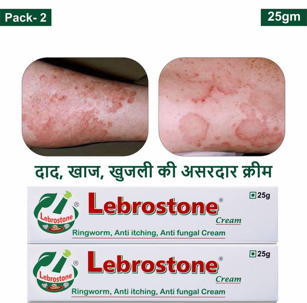 Lebrostone Ayurvedic Skin Care Treatment Cream 25g – For Ringworm, Itching & Fungal Infections (Pack of 2)