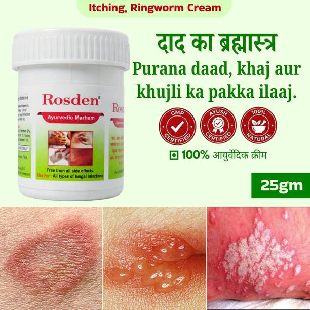 Rosden Herbal Skin Malam 25g – Daad, Khaj, Itching