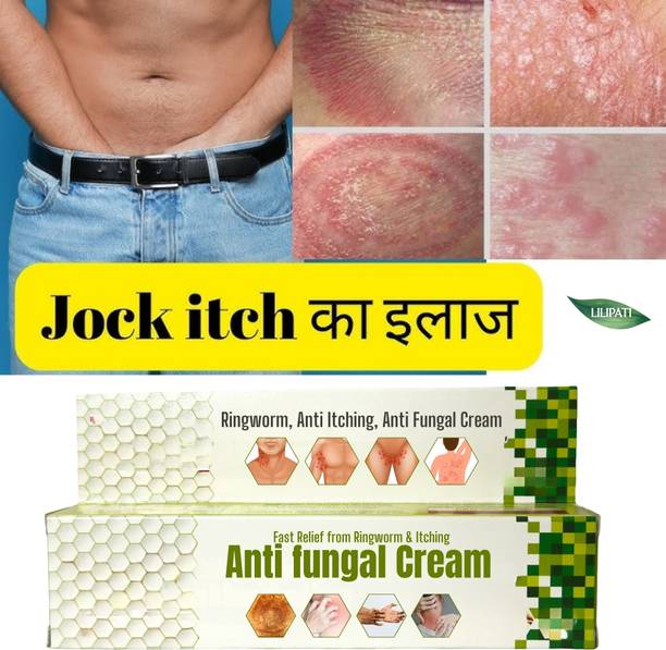 LILIPATI Ringworm Treatment Cream for Fast Relief | Anti-Itch & Antifungal Cream for Skin Allergy, Rash & Infection