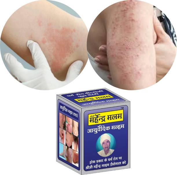 RAHIPA Shreeji Marhendra Fungal Infection Treatment Cream | Ayurvedic Malam for Itching & Ringworm...