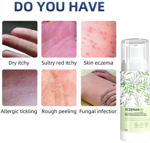 Eczemaron Ringworm Malam For Anti Dad Khaj Khujli, Skin fungal Infection, Eczema, itching, Fungus, Ringworm Ointment