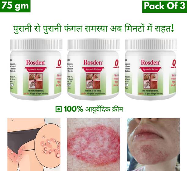 Rosden Ayurvedic Marham Anti fungal Cream - for Ringworm, itching Cream, Eczema & Skin Infection
