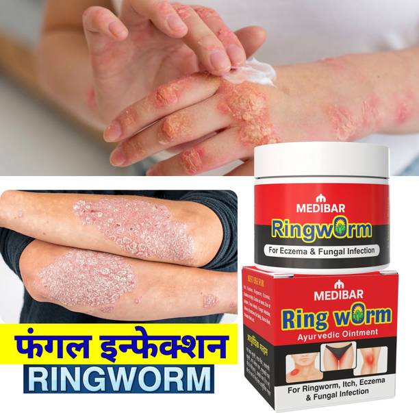 medibar "Ayurvedic Malam for Ringworm, itching, Eczema & Fungal Infection" (Pack of -1 )_