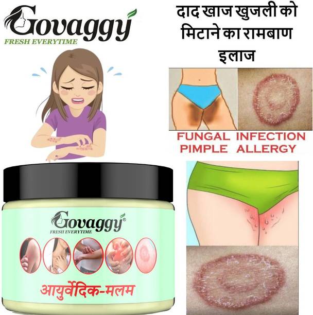 Govaggy Anti-Fungal Ayurvedic Balm for Itching, Rashes & Eczema