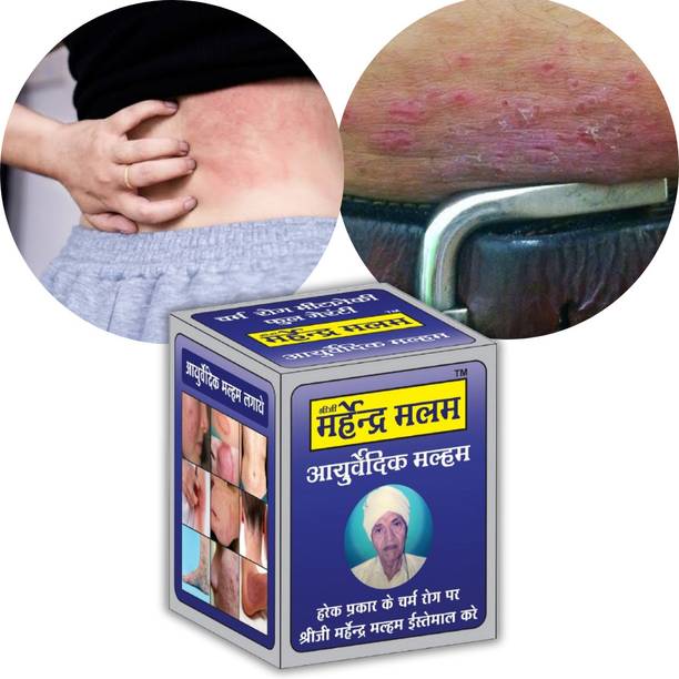 RAHIPA Shreeji Marhendra Ayurveda Marham Dad Khaj Khujli Itch Coat fungal Malam Ointment - for Ringworm, itching & Skin Infection, Skin Tretment, Skin Care