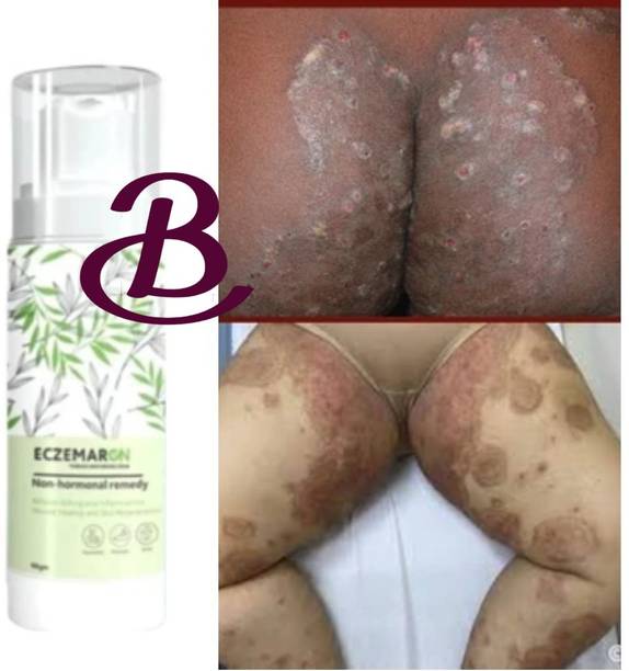 BIFRRUTANT Eczemaron Anti Fungal Cream Herbal Cure for Body Fungus
