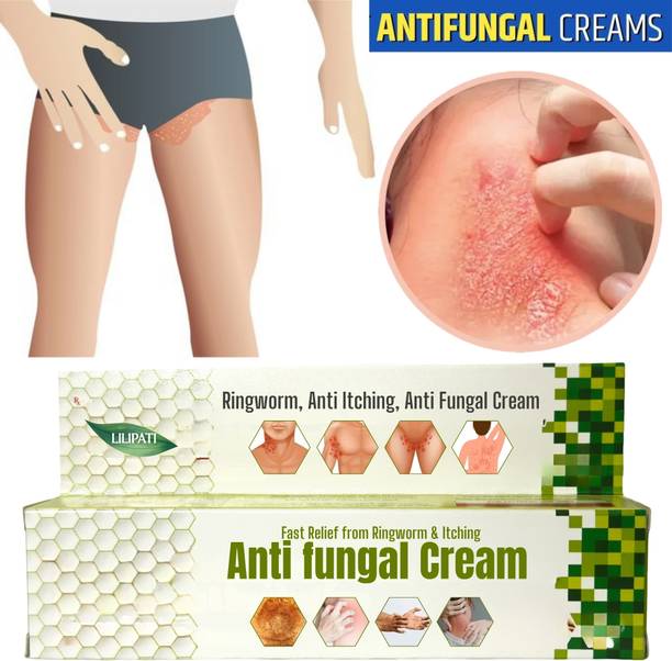 LILIPATI Daad Khaj Khujli Cream – Anti Fungal Treatment for Ringworm, Itching & Skin Infection Relief
