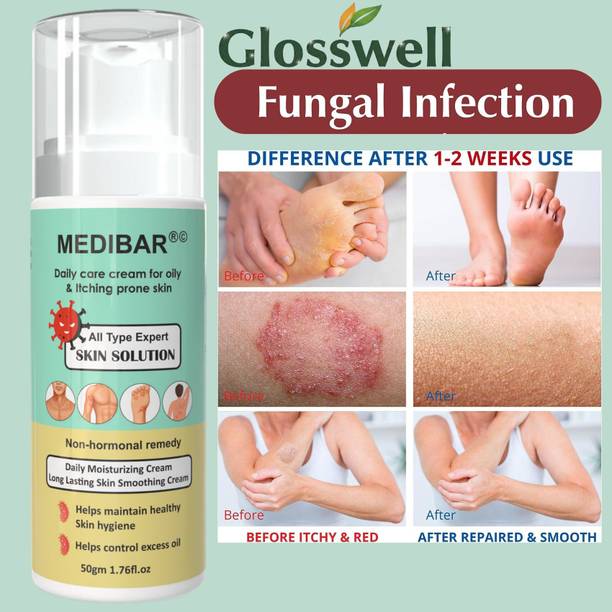 glosswell Herbal Antifungal Cream for Daily Skin Comfort