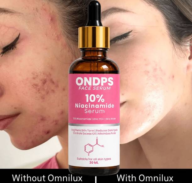 ONDPS XX19 10% Niacinamide Face Serum Reduce Acne Marks Bright Skinn.