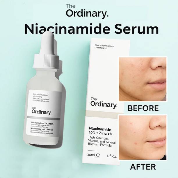 ANUA the Ordinary Niacinamide 10% + Zinc 1% Serum for a smoother appearance and brightening