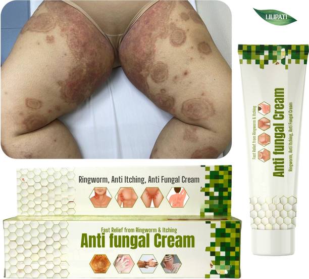 LILIPATI Ayurvedic Anti Fungal Cream for Skin Infection, Itching & Private Parts Relief | Daad Khaj Khujli Cream