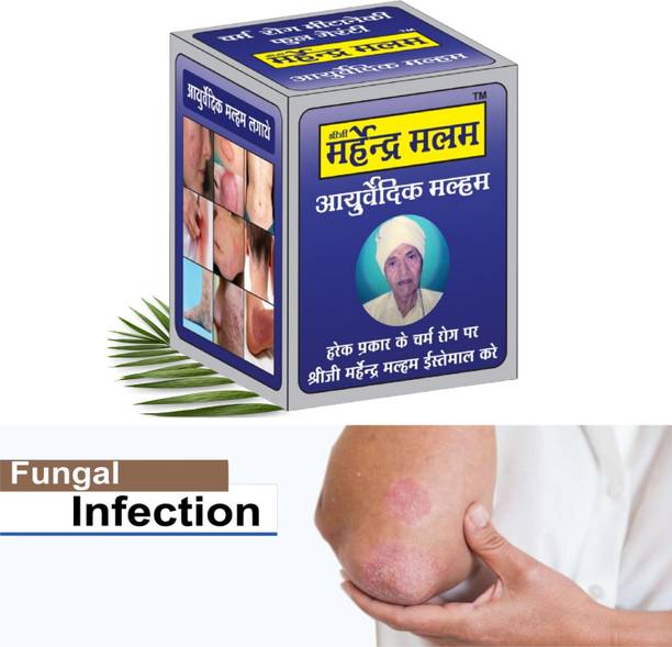 LILIPATI Ringworm Natural anti -(Shreeji Marhendra Malam ) fungal cream for Ringworm, Skin infections, Jock itch, chafing, Skin rash, Skin allergy