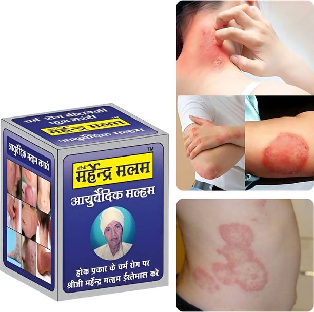 Rudramani Anti fungal Malam - for Ringworm, itching, Eczema .Skin Infection,All Skin