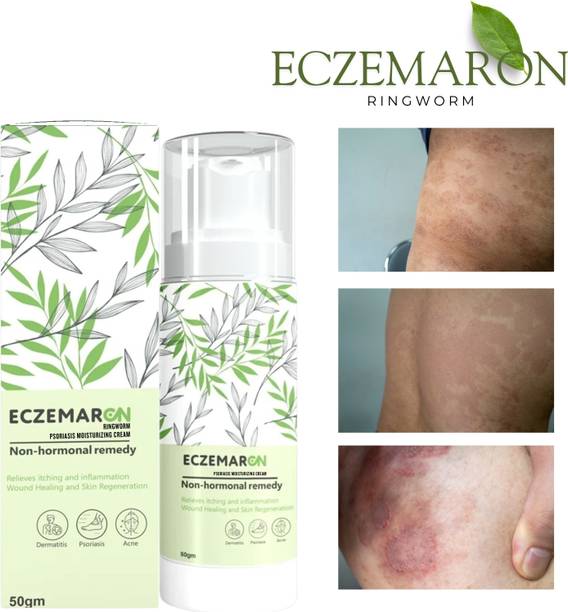 Eczemaron Ringworm Moisturizes and Soothes Feet skin Cream