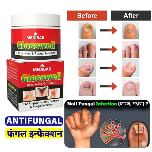 glosswell Advanced Ayurvedic Antifungal Skin Care Cream for Ringworm and Itching Relief