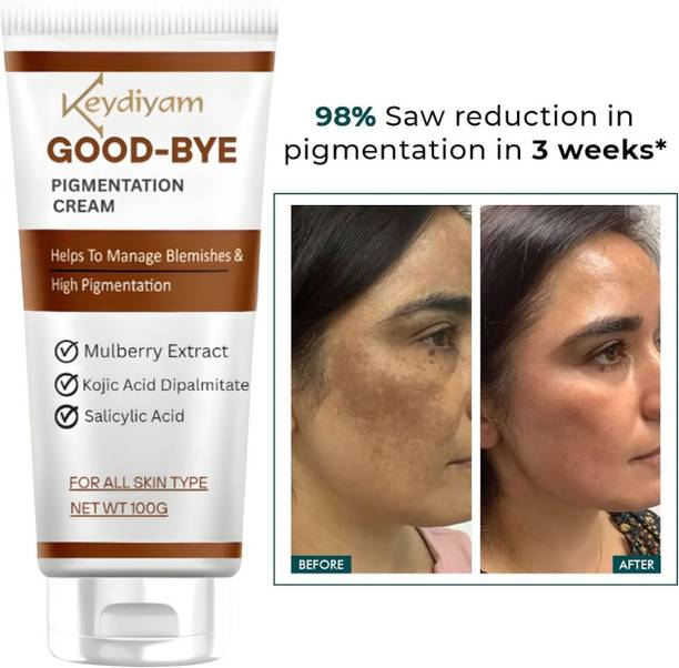 keydiyam Good-Bye Pigmentation Face Cream