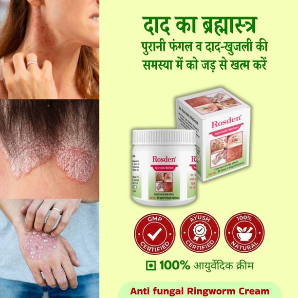 Rosden Herbal Ringworm Cream 25g – Daad Khaj Control
