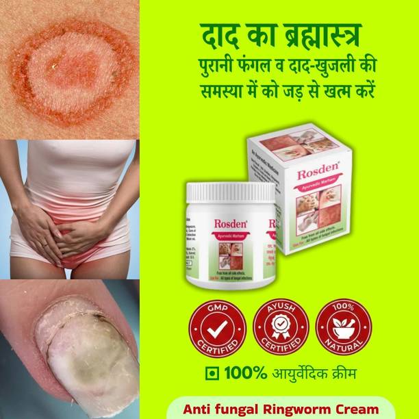 Rosden Daad Khaj Itching Cream 25g – Herbal Antifungal Formula