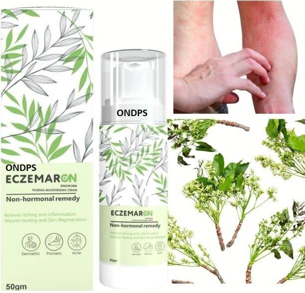 ONDPS Herbal Eczemaron anti fungal cream