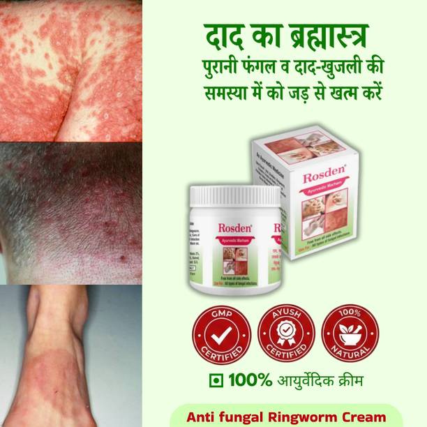 Rosden Herbal Antifungal Cream 25g – Daad, Khaj, Itching Relief