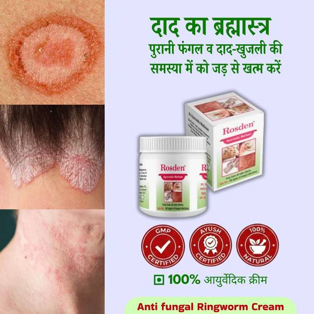 Rosden Ayurvedic Fungal Infection Cream 25g – Skin Itch Relief