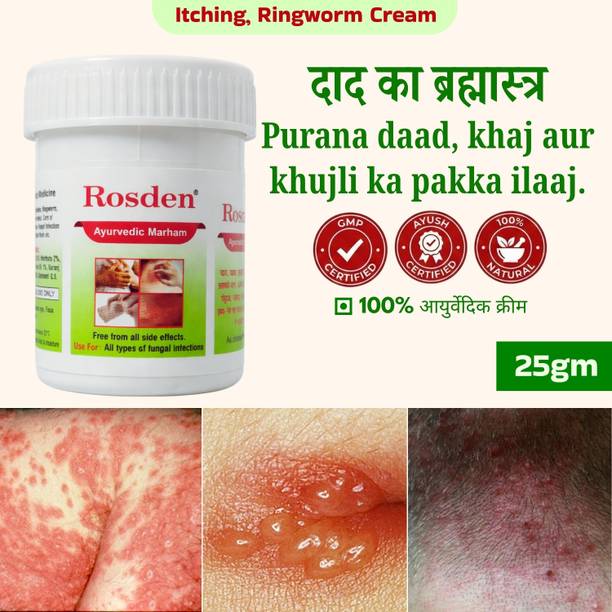 Rosden Ayurvedic Ringworm Malam 25g – Antifungal Relief