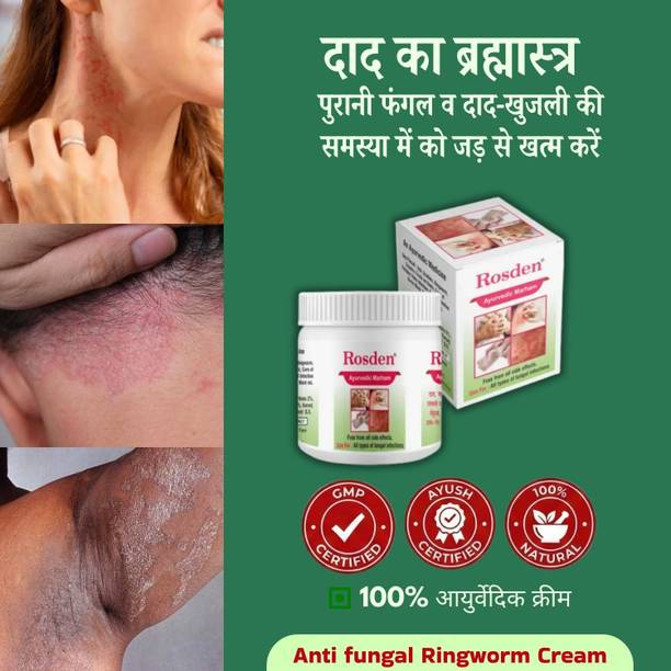 Rosden Ayurvedic Skin Care Malam 25g – Itching & Fungal Relief