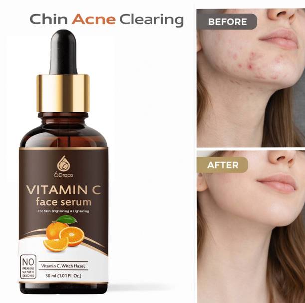 6Drops Vitamin C Face Serum for Fresh & Moisturized Skin | 30ml