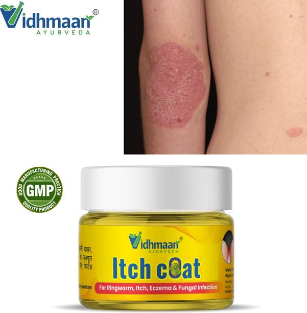 vidhmaan ayurveda ayurvedic special Fungal Cream For Men & Women | Ayurvedic ItchCoat Anti fungal Malam for Ringworm, itching, Eczema cream