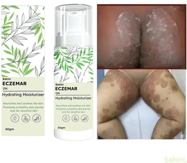 sahini Eczema & Fungal Solution With Soothing Botanicals