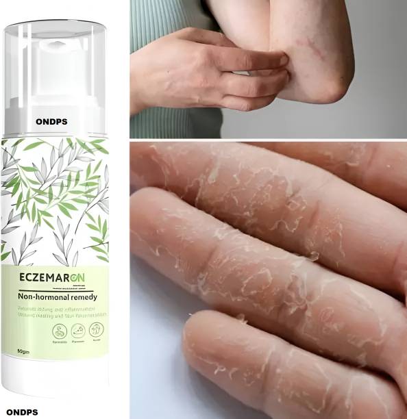 ONDPS Eczemaron Anti Fungal Cream spray For Men & Women 3.40
