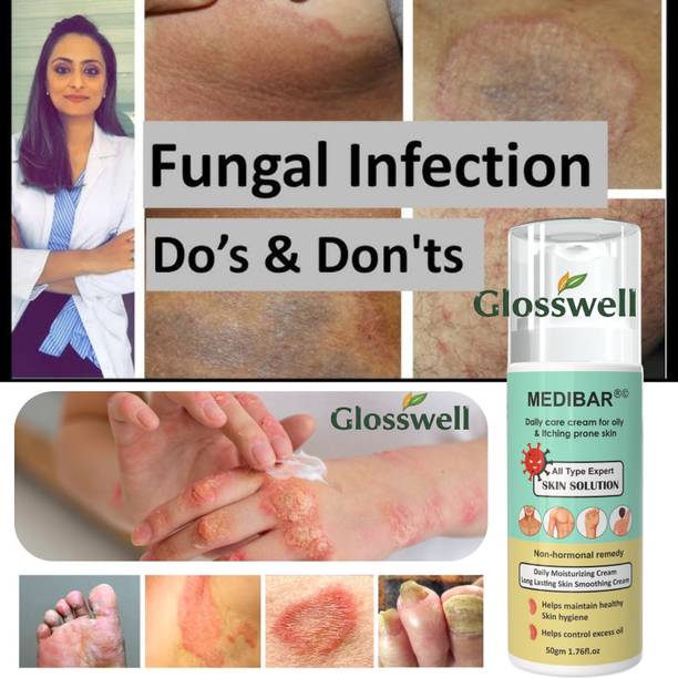 glosswell Ayurvedic Itch Care Cream for Daily Skin Comfort