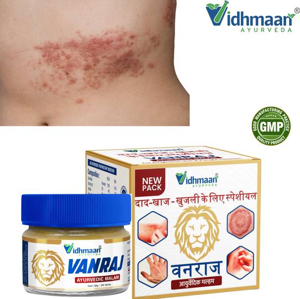 vidhmaan ayurveda Vanraj Skin Healing Malam – Ringworm & Eczema Relief
