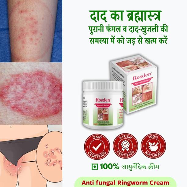 Rosden Herbal Daad Khaj Malam 25g – Skin Infection Relief