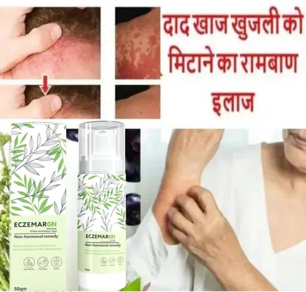 Eczemaron Ringworm HERBHEAL Eczemaron Anti Fungal Cream For Men & Women (50 g) Men & Women (50 ml)