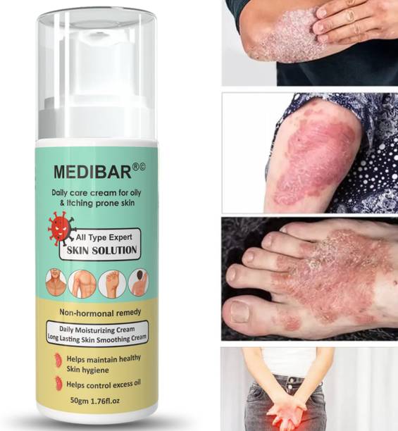 medibar Cream For AntiFungal, Itching, Ringworm, Eczema Skin Treatment