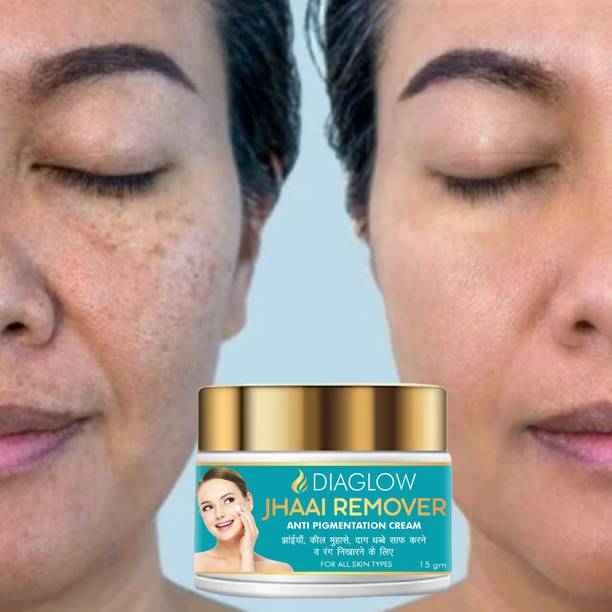 Diaglow Jhaai Remover Anti Pigment Spot Remover Cream For Remove Pimple Marks pack-1