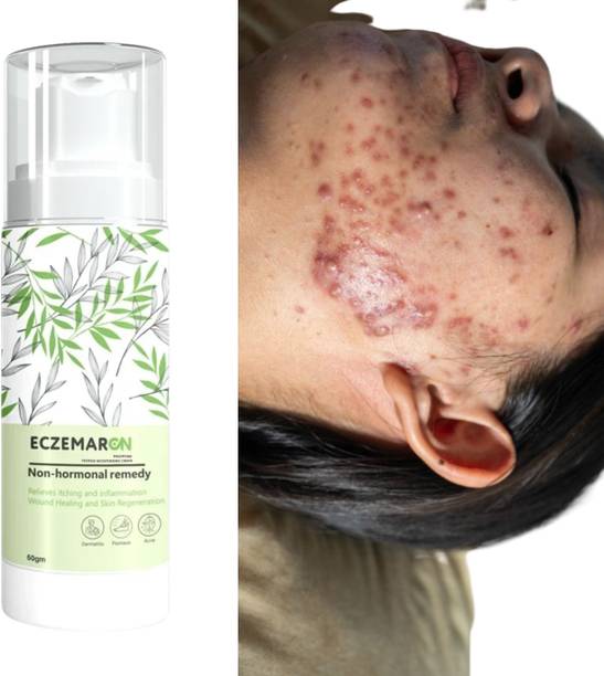 Eczemaron Ringworm Skin Strong & Repair Ringworm New Boost Cream (50 g)