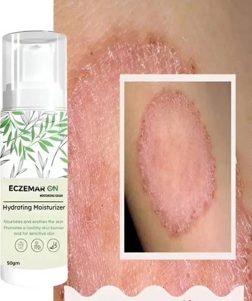 Acufit Eczemaron Anti Fungal Cream For Men & Women