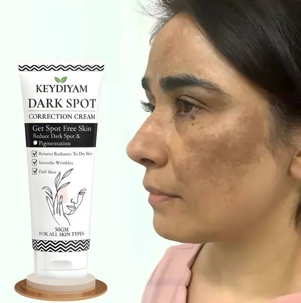 keydiyam Dark Spot Remover Cream, Fades Acne Scars & Evens Skin Tone (50 g)