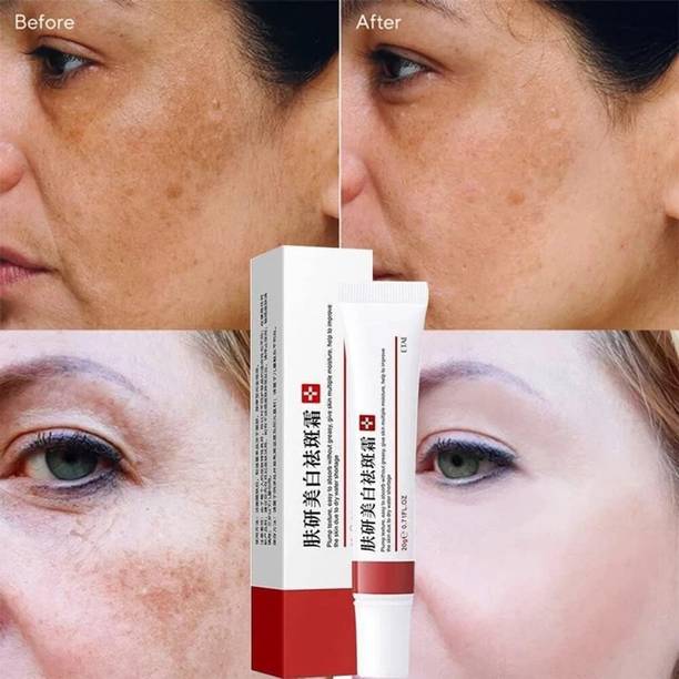 BRICIA Dark Spot Remover Cream for Face, Body & Sensitive Areas