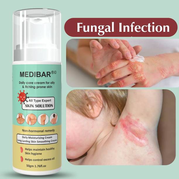 medibar Cream For AntiFungal, Itching, Ringworm, Dad Khaj Khujali, Skin Treatment