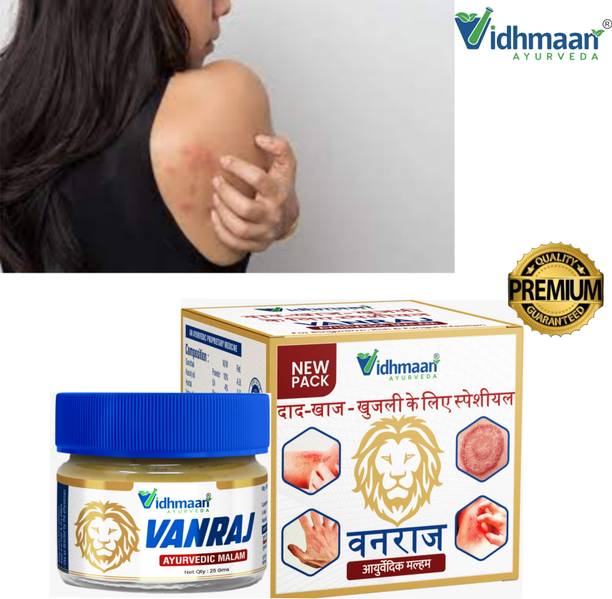 vidhmaan ayurveda VANRAJ Anti‑Fungal Itch Ointment – Skin Grievance Solution