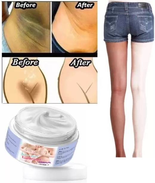 EVERERIN Bikini Skin Whitning And Darkness Reduction Cream For All Skin Type(BH)
